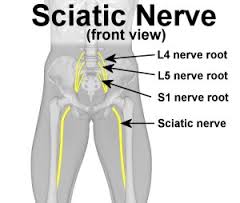 What physical therapy helps sciatica?