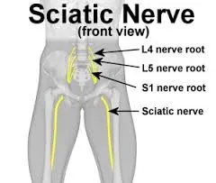What physical therapy helps sciatica?
