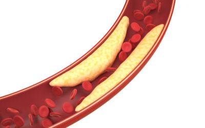 Reverse the Pressure: How Movement Rebuilds the Body from Hypertension