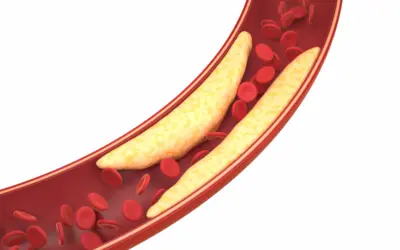 Reverse the Pressure: How Movement Rebuilds the Body from Hypertension